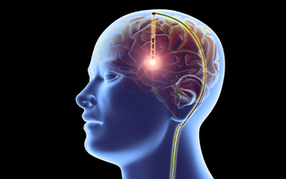 LWL | Brain Implant Maintain Memories