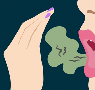 LWL | How is Fusobacterium nucleatum Associated with Halitosis