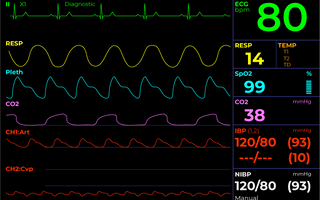 LWL | A Comprehensive Review of The Impact of Sedated Anesthesiology on Brain Development across a Lifespan